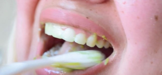 Bezpečné bělení zubů doma